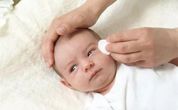 寶寶眼屎多是怎么回事？怎么清理？