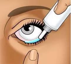 點眼藥水的正確步驟和姿勢