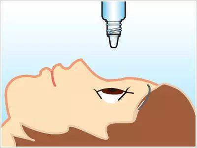 近視手術(shù)要多久才能恢復(fù)視力？恢復(fù)期間會不會影響正常生活？