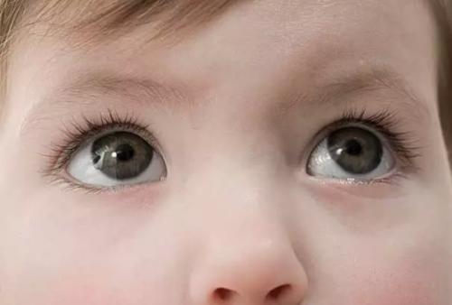 干眼癥是眼病嗎？可以治療嗎？