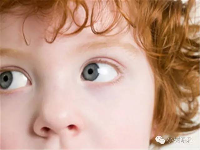 三個(gè)細(xì)節(jié)影響寶寶視力 三個(gè)細(xì)節(jié)影響寶寶視力