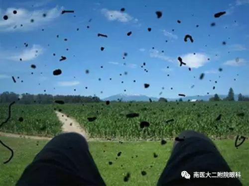 高度近視患者注意六大事項