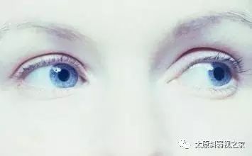 轉眼珠能提高記憶力?還改善視力? 轉眼珠能提高記憶力?還改善視力?