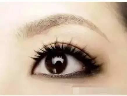 雙眼皮術后出現上瞼下垂怎么辦？