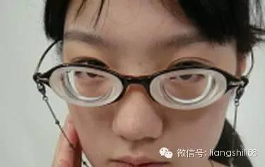 警惕，高度近視眼底病變