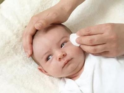 寶寶眼屎多是怎么回事？怎么清理？