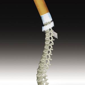 吸煙竟會引起弱視?