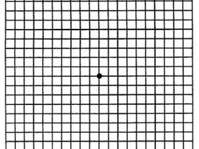 什么是阿姆斯勒表?如何使用?