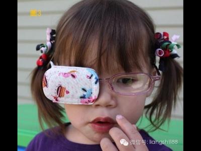 弱視治療防止復發四個要點