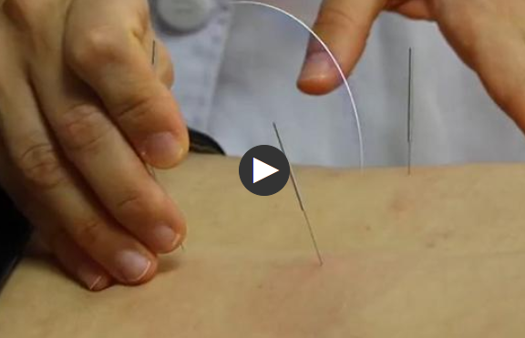 12名葡萄牙“洋中醫”江西進修，“解鎖”中醫新技法