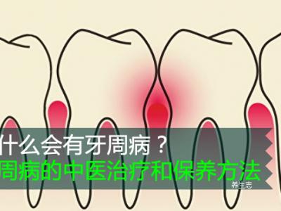 為什么會有牙周病?牙周病的中醫治療和保養方法
