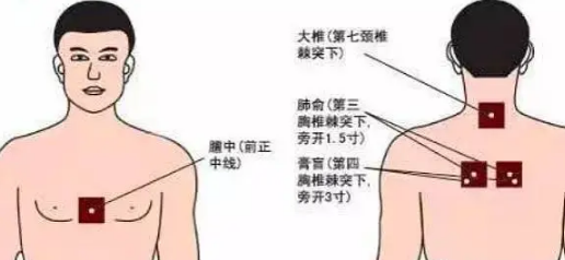 三伏貼貼什么位置圖-易網<a href=http://www.xllyou.com/ target=_blank class=infotextkey>健康養(yǎng)生</a>網 三伏貼貼什么位置圖
