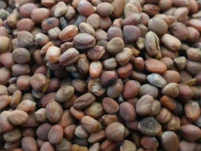 坐骨神經(jīng)痛八忌 四個技巧趕走坐骨神經(jīng)痛