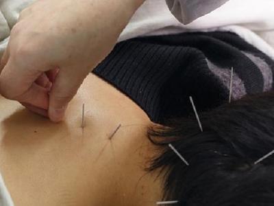 中醫針灸應如何治療麥粒腫 中醫針灸治療麥粒腫的5個方法