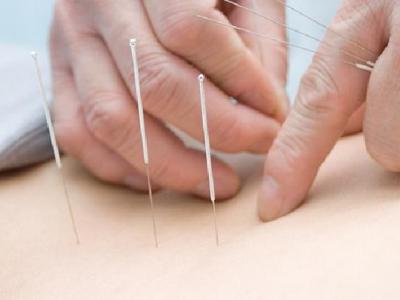 中醫治療青光眼有哪些好的方法 中醫按摩針灸治青光眼效果更好