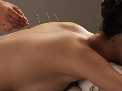 中醫針灸治療酒渣鼻療效怎么樣 中醫針灸治療酒渣鼻的兩大療法