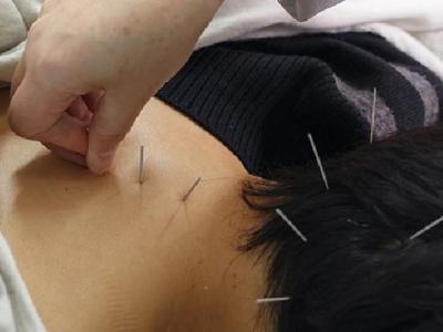 酒渣鼻的治療方法是什么 中醫針治療酒渣鼻的兩個治法