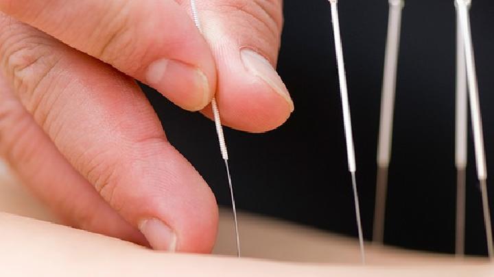 眼角常長斑到底是怎么回事? 雀斑的中醫針灸療法介紹-易網健康養生網 眼角常長斑到底是怎么回事? 雀斑的中醫針灸療法介紹