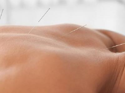 教師群體易患干眼癥該怎么治療 得了干眼癥不妨試試針灸療法