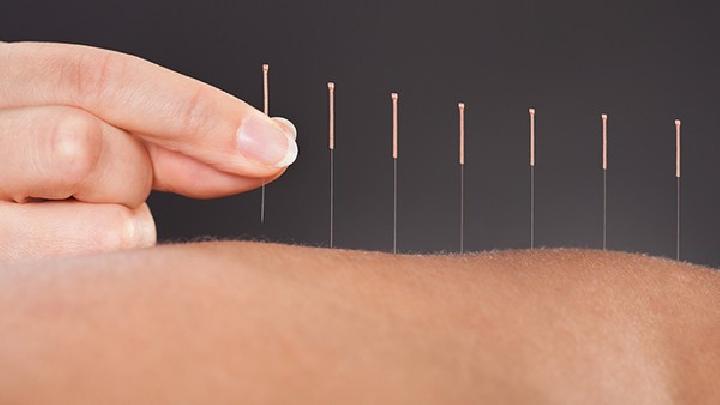 男性不育最有效的治療方法是什么 中醫針灸能徹底治愈男性不育癥-易網<a href=http://www.xllyou.com/ target=_blank class=infotextkey>健康養生</a>網 男性不育最有效的治療方法是什么 中醫針灸能徹底治愈男性不育癥