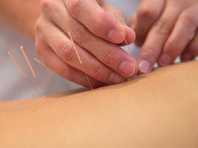 腦出血后障礙怎么治療效果最好 中醫針灸穴位可治療腦出血后障礙