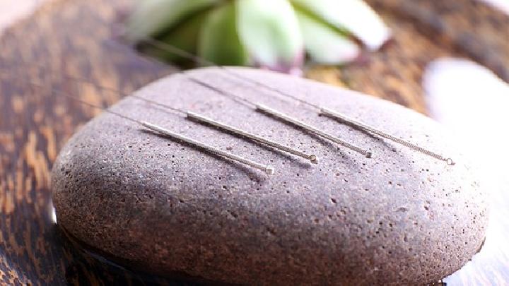 中醫(yī)針灸治鼻炎會(huì)有風(fēng)險(xiǎn)嗎 專家解讀針灸治鼻炎的具體事宜-易網(wǎng)<a href=http://www.xllyou.com/ target=_blank class=infotextkey>健康養(yǎng)生</a>網(wǎng) 中醫(yī)針灸治鼻炎會(huì)有風(fēng)險(xiǎn)嗎 專家解讀針灸治鼻炎的具體事宜