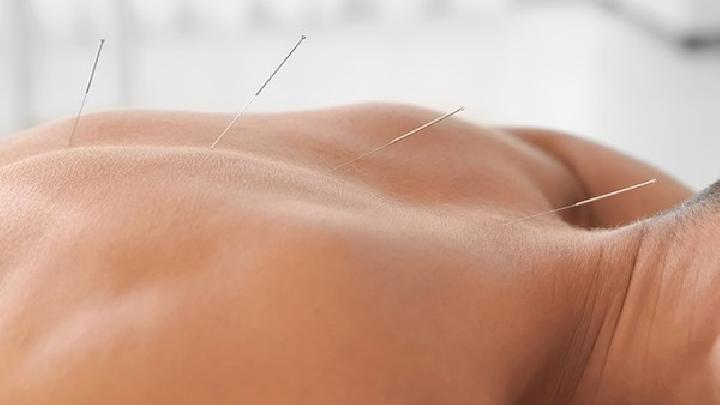 得了急性乳腺炎怎樣針灸治療 女性急性乳腺炎有什么癥狀表現