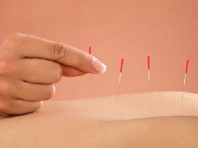 得了急性乳腺炎怎樣針灸治療 女性急性乳腺炎有什么癥狀表現(xiàn)