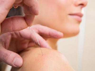 中醫針灸治療耳聾的方法是什么 4個中醫解決耳聾針灸治療方法