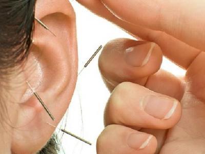 女性經期可以針灸嗎 中醫針灸能治痛經嗎