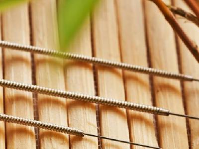 中醫(yī)針灸治蕁麻疹需要注意些什么 中醫(yī)針灸治蕁麻疹有三大止癢要點(diǎn)