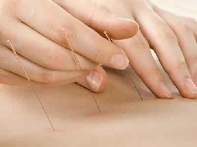 為什么男性有附睪炎？男性附睪炎的中醫針灸療法分析