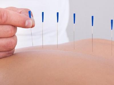 導致女性痛經的原因是什么?女性緩解痛經可試針灸治療