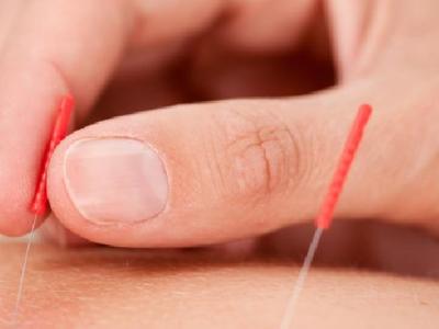 女性月經不調怎么辦才能改善 中醫針灸按摩療法有效改善月經不調