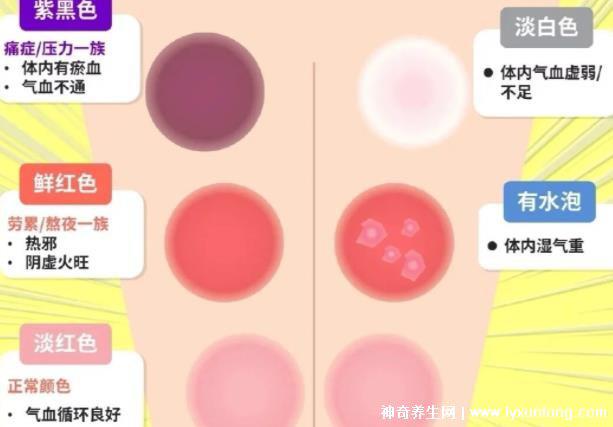 拔罐顏色癥狀對照表，紅色/黃色/藍色代表各不同(顏色深淺圖解)