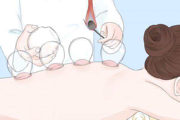 拔火罐祛濕的最佳部位