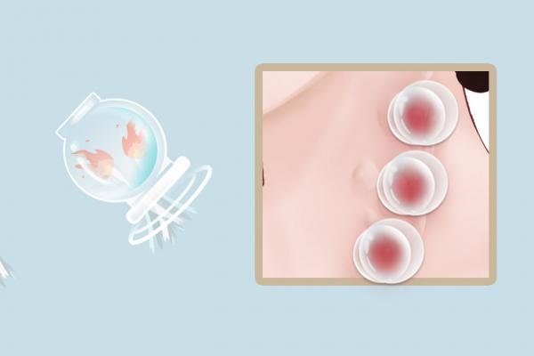 拔罐后多久可以吹空調(diào)