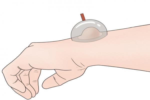 拔火罐祛濕的最佳部位