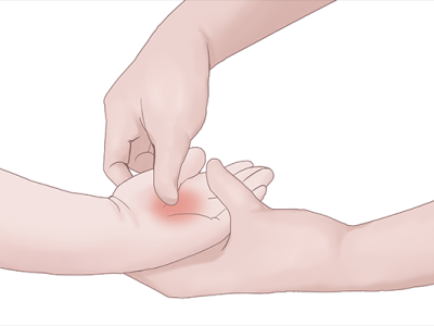 上中下三焦祛濕方法